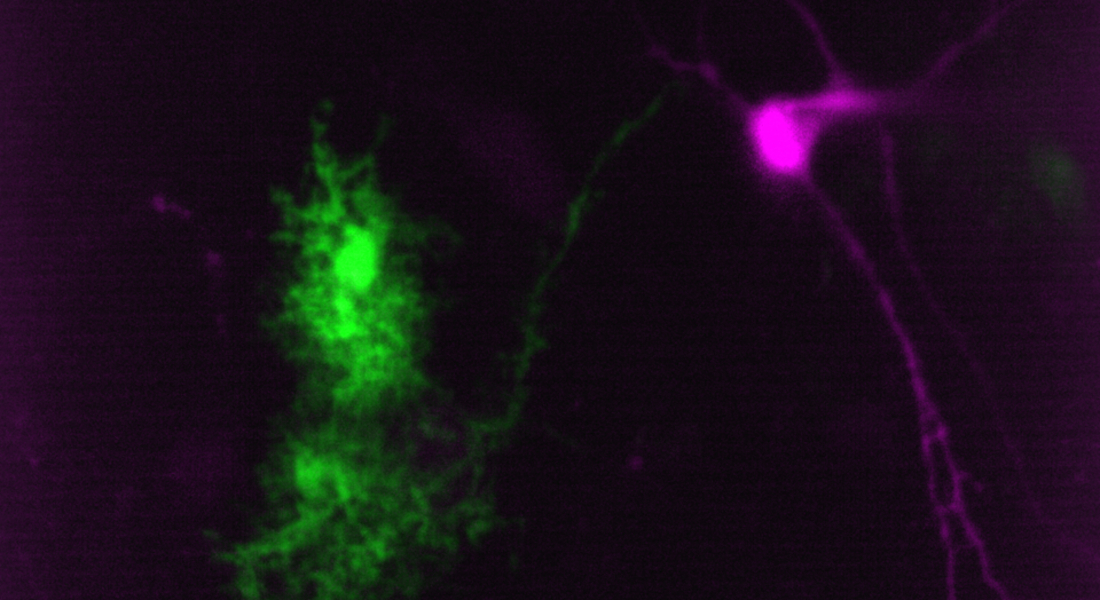 neuron and astrocyte