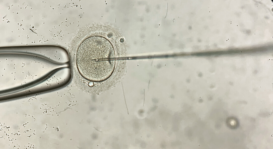 Close-up of IVF treatment