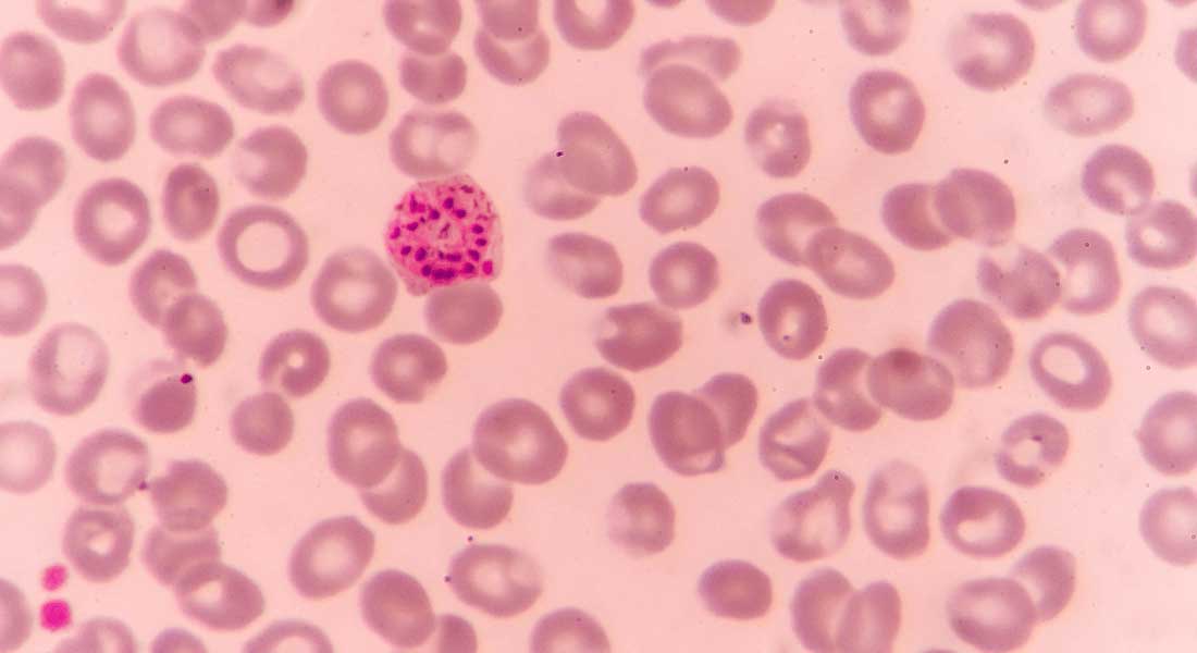 The Malaria parasite in human blood cells. Photo: Canva.