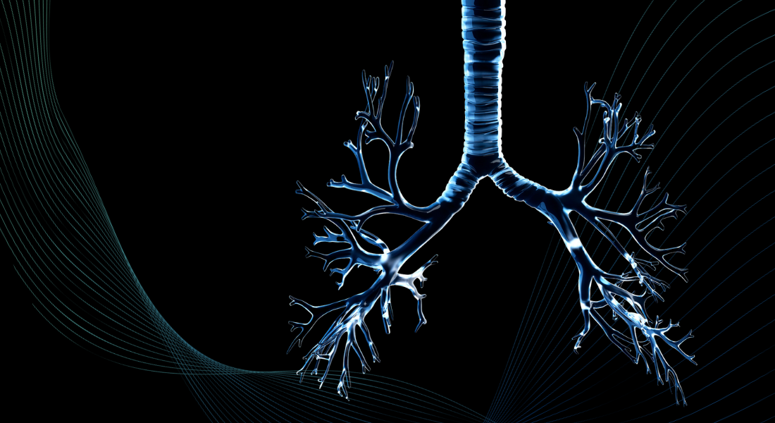 Innovation project from UCPH.