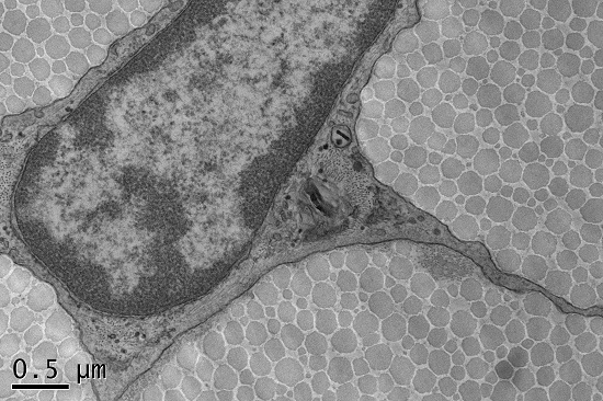 Electron microscopy image of a mouse tendon cross section showing a cell embedded in a dense matrix of collagen fibrils.